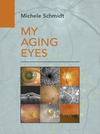 My Aging Eyes
