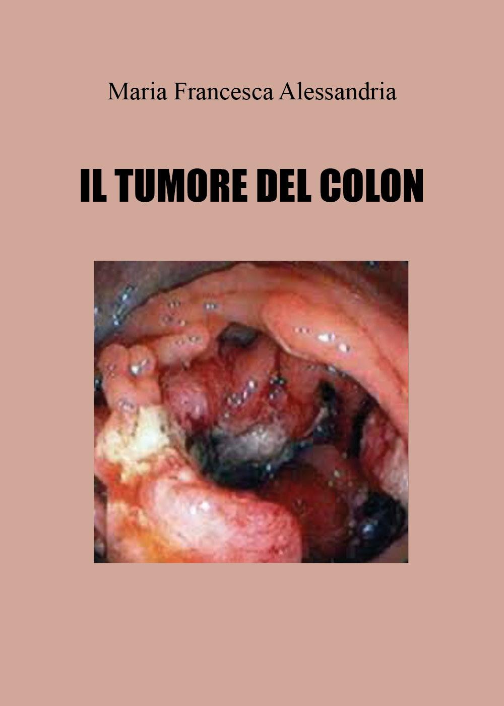 Il tumore del colon