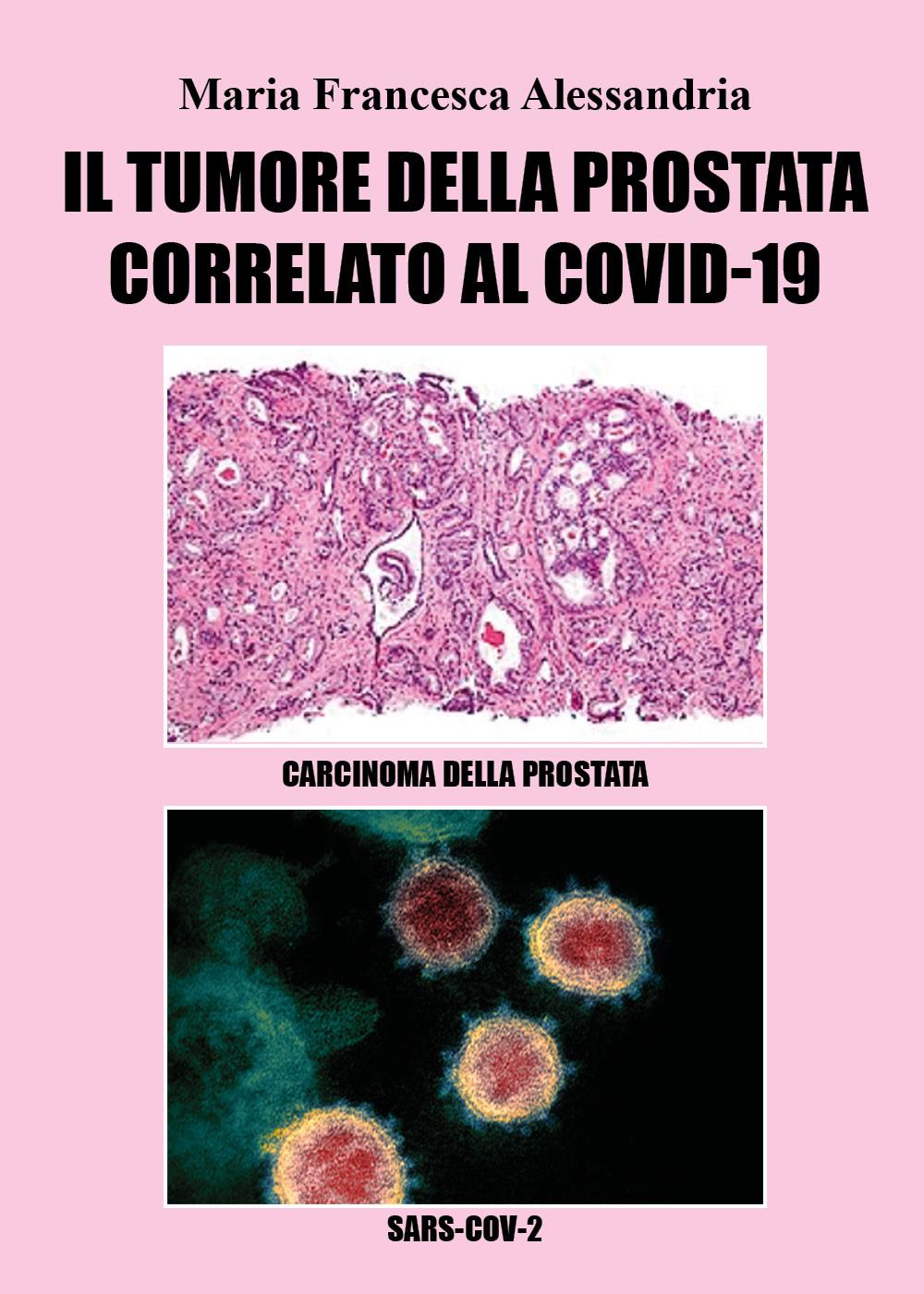 Il tumore alla prostata correlato al Covid-19
