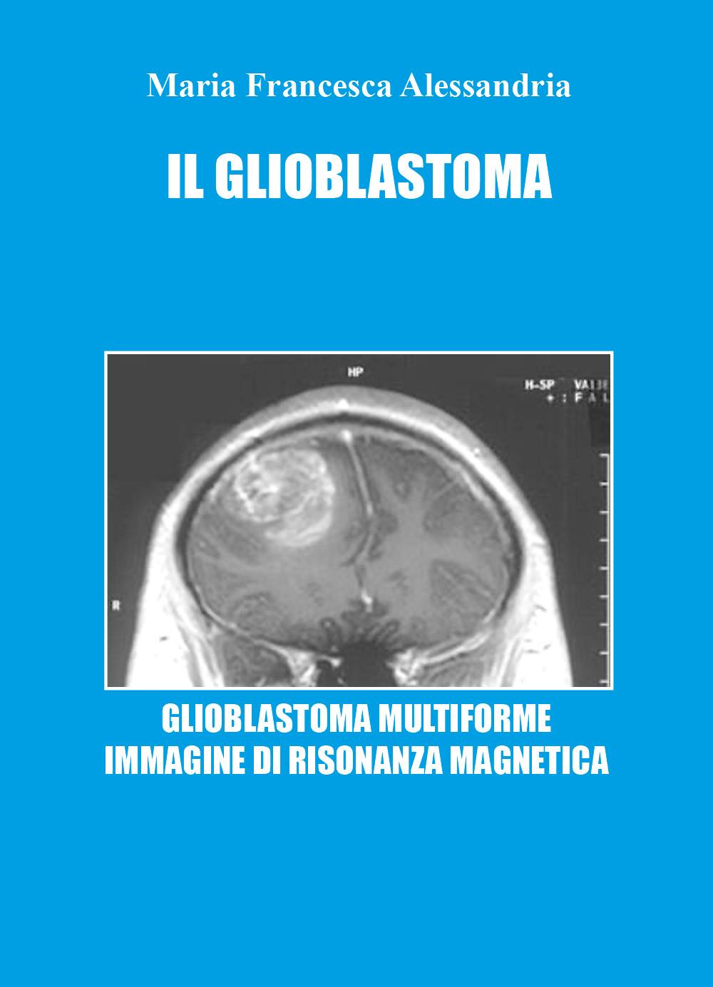 Il Glioblastoma