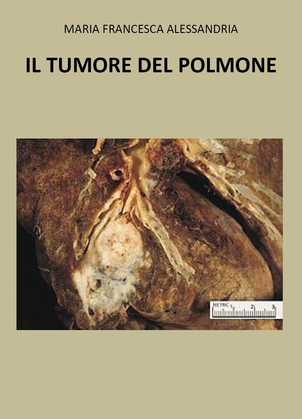 Il tumore nel polmone
