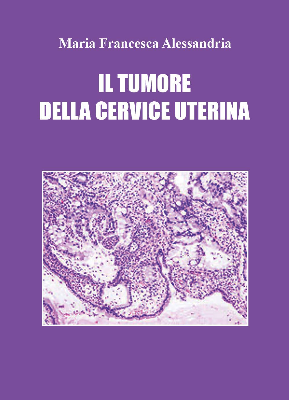 Il tumore della cervice uterina